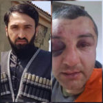 მერაბის ადგილას მეც იგივეს გავაკეთებდი -გუდაურში მომხდარი მკვლელობის შესახებ – ზურა მირზიაშვილი ანსაბლ ანანურის სოლისტი